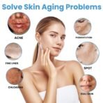 20g Freckle Cream for Face,  Melasma Dark Spots Wrinkles Blemishes (freckle cream), Elasticity & Hydration Care, Reduces Sagging & Dullness - Image 3