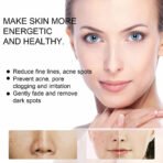 20g Freckle Cream for Face,  Melasma Dark Spots Wrinkles Blemishes (freckle cream), Elasticity & Hydration Care, Reduces Sagging & Dullness - Image 5