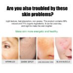 20g Freckle Cream for Face,  Melasma Dark Spots Wrinkles Blemishes (freckle cream), Elasticity & Hydration Care, Reduces Sagging & Dullness - Image 7