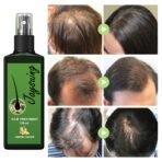 120ml Jaysuing Hair Growth Oil Strong hair Scalp Massage Liquid Fast Growing Germinal Anti-loss Treatment Serum Hair Lotion - Image 2
