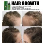 120ml Jaysuing Hair Growth Oil Strong hair Scalp Massage Liquid Fast Growing Germinal Anti-loss Treatment Serum Hair Lotion - Image 5