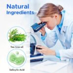 360PCS Transparent Acne Patch Round Size Available For Men And Women Apply Acne Patch