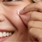 360PCS Transparent Acne Patch Round Size Available For Men And Women Apply Acne Patch - Image 3