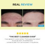 CeraVe Moisturising Lotion | 236ml | Daily Face, Body & Hand Moisturiser for Dry to Very Dry Skin - Image 5